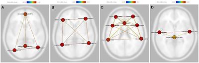 Subclinical alterations of resting state functional brain network for adjunctive bright light therapy in nonseasonal major depressive disorder: A double blind randomized controlled trial